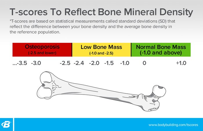 Building Stronger Bones with Lifestyle Choices